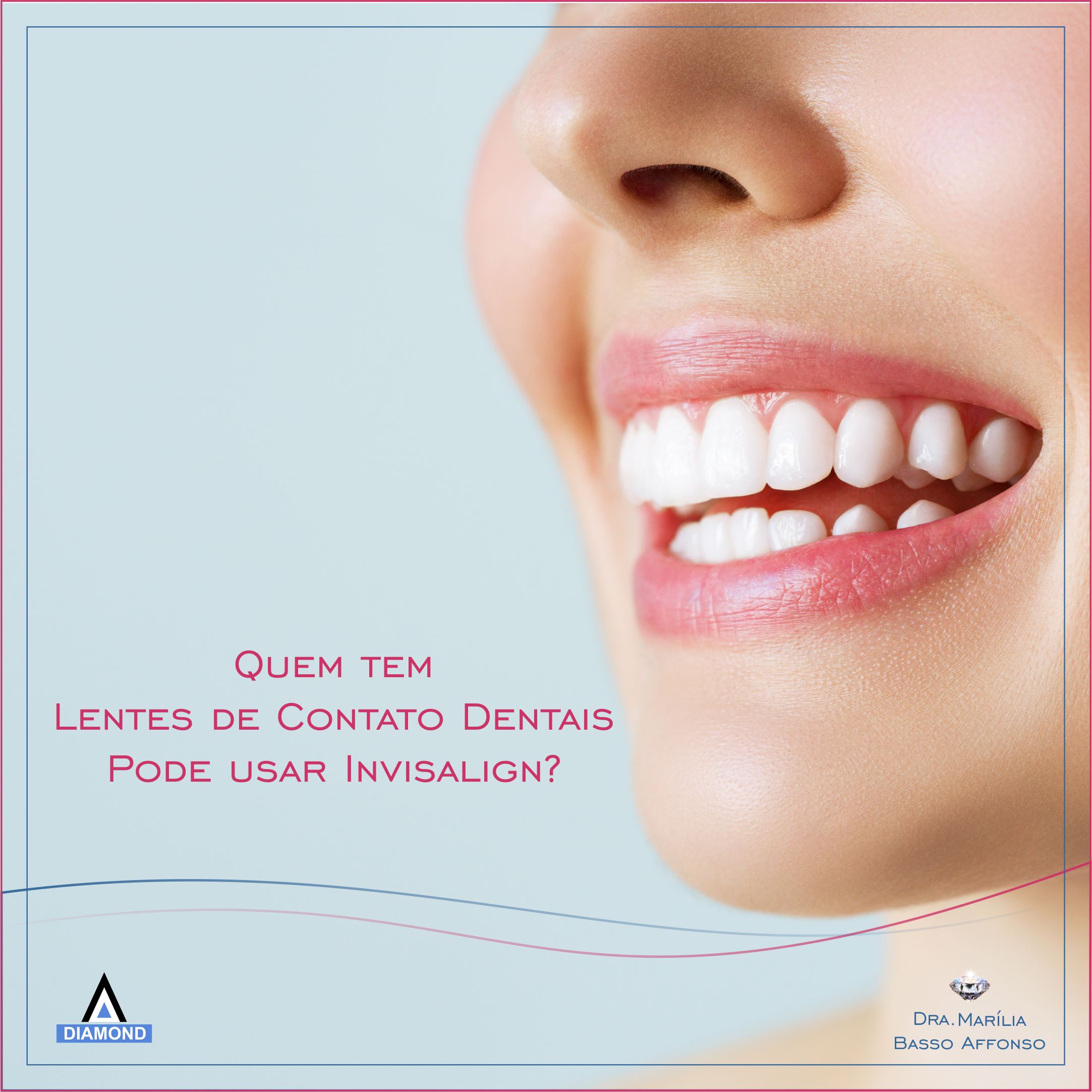 Quem tem lentes de contatos dentais pode usar Invisalign? – Dra